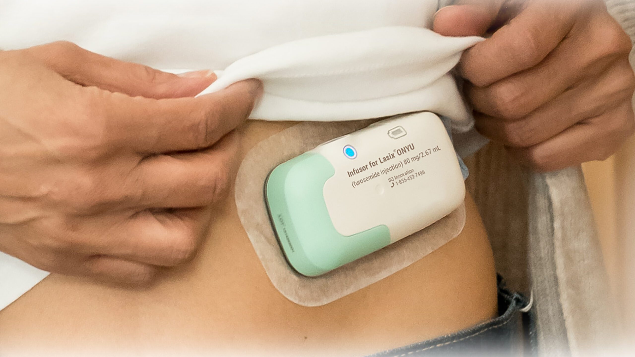 Infusor on the body